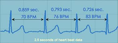 Heart Rate variability is a measure of beat-to-beat changes in heart rate.