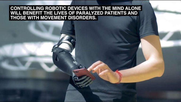 First-ever Successful Mind-controlled Robotic Arm Without Brain ...